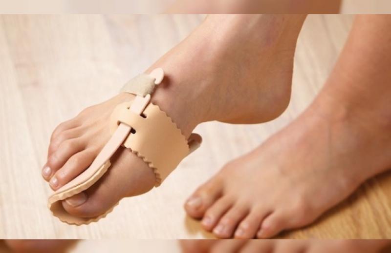 Ayak Baş Parmak Türleri ve Özellikleri